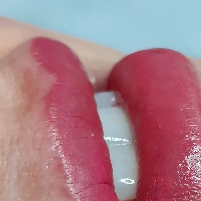 Revitalização labial